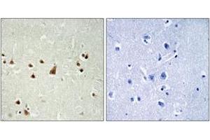 Immunohistochemistry analysis of paraffin-embedded human brain, using ANKRD26 Antibody. (ANKRD26 antibody  (AA 791-840))