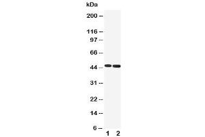 Western blot testing of 5HT1A Receptor antibody and Lane 1:  rat brain (Serotonin Receptor 1A antibody  (C-Term))