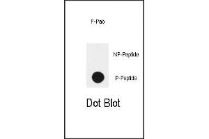 Dot blot analysis of anti-EGFR-p Phospho-specific Pab (ABIN389792 and ABIN2839693) on nitrocellulose membrane. (EGFR antibody  (pTyr1172))