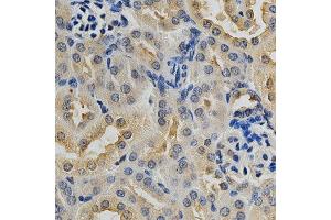 Immunohistochemistry of paraffin-embedded mouse kidney using MAPK10 antibody at dilution of 1:200 (x400 lens)