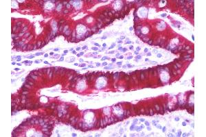 Solute Carrier Family 35 (UDP-GlcNAc/UDP-Glucose Transporter), Member D2 (SLC35D2) (C-Term) antibody