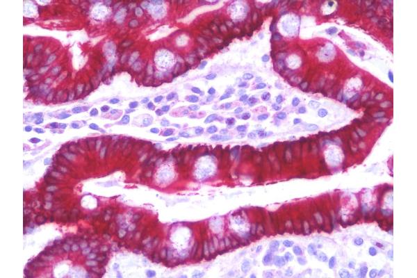 Solute Carrier Family 35 (UDP-GlcNAc/UDP-Glucose Transporter), Member D2 (SLC35D2) (C-Term) antibody