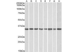 Western Blotting (WB) image for anti-Guanine Nucleotide Binding Protein (G Protein), beta Polypeptide 2-Like 1 (GNB2L1) (Internal Region) antibody (ABIN768551)