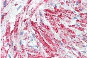 Human Prostate, Stroma: Formalin-Fixed, Paraffin-Embedded (FFPE) (beta Actin antibody  (AA 1-376))