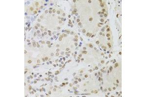 Immunohistochemistry (Paraffin-embedded Sections) (IHC (p)) image for anti-RuvB-Like 1 (E. Coli) (RUVBL1) (AA 1-240) antibody (ABIN6147319)