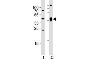 Western blot analysis of (1) zebrafish brain and (2) whole zebrafish tissue lysate using Ada antibody. (ADA antibody  (AA 114-148))