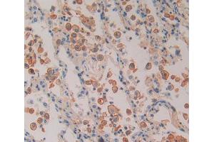 Used in DAB staining on fromalin fixed paraffin- embedded Kidney tissue (PSMD5 antibody  (AA 143-341))