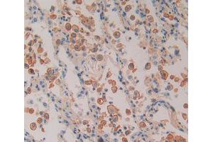 Used in DAB staining on fromalin fixed paraffin- embedded Kidney tissue (Proteasome 26S Subunit, Non ATPase 5 (AA 143-341) antibody)