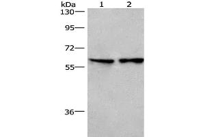 Western Blot analysis of Lovo cell and Mouse lung tissue using CD244 Polyclonal Antibody at dilution of 1:526 (2B4 antibody)