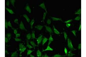 Immunofluorescent analysis of Hela cells using ABIN7145271 at dilution of 1:100 and Alexa Fluor 488-congugated AffiniPure Goat Anti-Rabbit IgG(H+L) (BATF3 antibody  (AA 2-65))