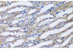 Immunohistochemistry of paraffin-embedded Mouse kidney using NQO2 Polyclonal Antibody at dilution of 1:100 (40x lens). (NQO2 antibody)