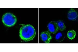Confocal immunofluorescence analysis of methanol-fixed HEK293 cells trasfected with AXL-hIgGFc using AXL antibody (green), showing cytoplasmic and membrane localization. (AXL antibody)