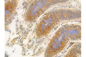 ABIN6261947 and ABIN6276873 at 1/100 staining human normal colon tissue by IHC-P.