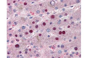 Anti-NACA antibody IHC of human liver. (NACA antibody  (C-Term))