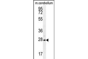 VSTM2A Antibody (Center) (ABIN655126 and ABIN2844754) western blot analysis in mouse cerebellum tissue lysates (35 μg/lane). (VSTM2A antibody  (AA 97-126))