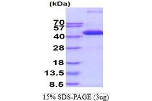 SDS-PAGE (SDS) image for Mitogen-Activated Protein Kinase 14 (MAPK14) (AA 1-360) protein (His tag) (ABIN667983)