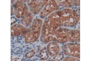IHC-P analysis of kidney tissue, with DAB staining. (TNXB antibody  (AA 3835-4088))