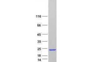 Validation with Western Blot
