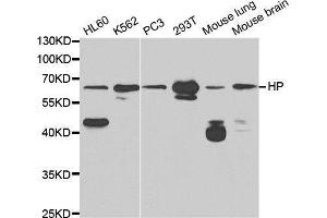 Western blot analysis of extracts of various cell lines, using HP antibody. (Haptoglobin antibody)