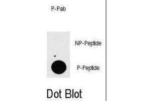 Dot Blot (DB) image for anti-TGF-beta Activated Kinase 1/MAP3K7 Binding Protein 1 (TAB1) (pSer423) antibody (ABIN3001819) (TAB1 antibody  (pSer423))