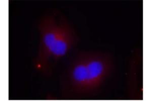 Image no. 2 for anti-PTK2 Protein tyrosine Kinase 2 (PTK2) (pTyr925) antibody (ABIN196825) (FAK antibody  (pTyr925))