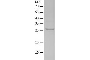 PDXP Protein (AA 1-292) (His tag)