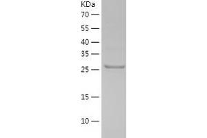 Western Blotting (WB) image for Pyridoxal (Pyridoxine, Vitamin B6) Phosphatase (PDXP) (AA 1-292) protein (His tag) (ABIN7286592) (PDXP Protein (AA 1-292) (His tag))