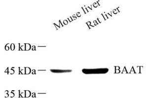 Western blot analysis of BAAT (ABIN7073212) at dilution of 1: 500 (BAAT antibody)