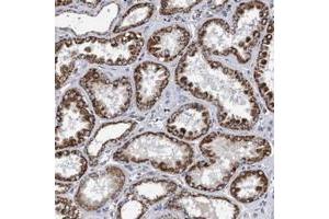 Immunohistochemical staining of human kidney with COBL polyclonal antibody  shows strong granular cytoplasmic positivity in tubular cells at 1:200-1:500 dilution. (COBL antibody)