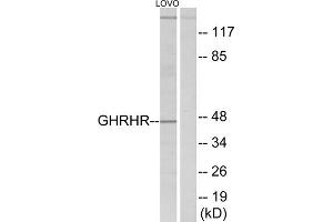 Western blot analysis of extracts from LOVO cells, using GHRHR antibody. (GHRHR antibody  (C-Term))