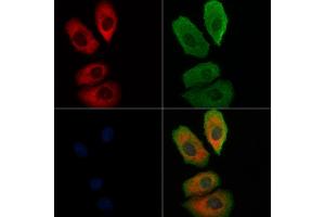 ABIN6262682 and ABIN6278311 staining Hela cells by IF/ICC.