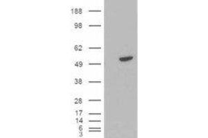 HEK293 overexpressing BLNK and probed with ABIN2561426 (mock transfection in first lane). (B-Cell Linker antibody  (C-Term))