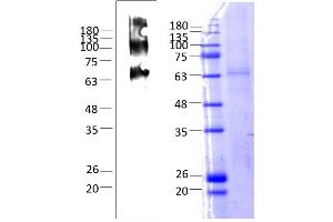Human Melanocortin 4 Receptor (MC4R) (AA 1-332), Fraction 10-12 (MC4R Protein (AA 1-332) (Strep Tag))