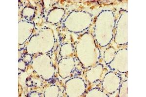 Immunohistochemistry of paraffin-embedded human thyroid tissue using ABIN7161000 at dilution of 1:100 (ME3 antibody  (AA 547-598))