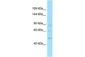Western Blotting (WB) image for anti-GTF2I Repeat Domain Containing 2 (GTF2IRD2) (C-Term) antibody (ABIN2789098) (GTF2IRD2 antibody  (C-Term))