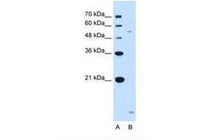 Image no. 2 for anti-ST3 beta-Galactoside alpha-2,3-Sialyltransferase 5 (ST3GAL5) (AA 151-200) antibody (ABIN321105)