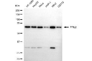 anti-Peptidylprolyl Isomerase (Cyclophilin)-Like 2 (PPIL2) antibody