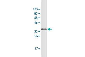 Western Blot detection against Immunogen (37. (ZBTB14/ZFP161 antibody  (AA 311-420))