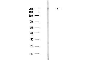 anti-Myoferlin (MYOF) (Internal Region) antibody