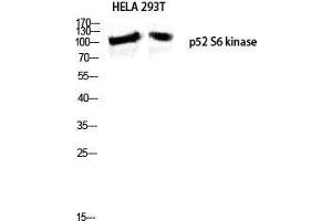 Western Blot (WB) analysis of HeLa 293T lysis using p52 S6 kinase antibody. (RPS6KC1 antibody  (Internal Region))