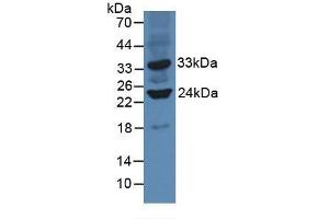 Figure. (SIRT3 antibody  (AA 5-257))