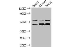 Western Blot Positive WB detected in: Mouse heart tissue, , Mouse kidney tissue, Mouse brain tissue All lanes: HNF4A antibody at 3 μg/mL Secondary Goat polyclonal to rabbit IgG at 1/50000 dilution Predicted band size: 53, 52, 47, 57, 51, 49, 44 kDa Observed band size: 53, 47 kDa (HNF4A antibody  (AA 130-330))