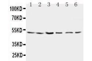 Anti-Presenilin 2 antibody, Western blotting Lane 1: Rat Brain Tissue Lysate Lane 2: Rat Brain Tissue Lysate Lane 3: MCF-7 Cell Lysate Lane 4: HELA Cell Lysate Lane 5: SMMC Cell Lysate Lane 6: CEM Cell Lysate (Presenilin 2 antibody  (N-Term))