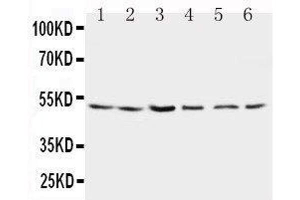 Presenilin 2 antibody  (N-Term)