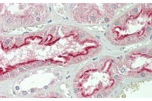 Detection of FOLR1 in Human Kidney Tissue using Polyclonal Antibody to Folate Receptor 1, Adult (FOLR1) (FOLR1 antibody  (AA 25-234))