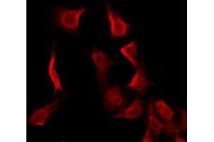ABIN6275971 staining HeLa by IF/ICC. (MC2R antibody  (N-Term))