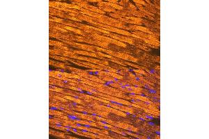 Immunofluorescence analysis of mouse heart using Tropomyosin 1 Rabbit mAb (ABIN7271013) at dilution of 1:100 (40x lens). (Tropomyosin antibody)