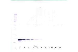 Image no. 2 for anti-Vascular Endothelial Growth Factor A (VEGFA) antibody (ABIN465336)