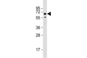 Western blot testing of mouse testis lysate with TOR1AIP1 antibody at 1:2000. (TOR1AIP1 antibody  (AA 42-76))