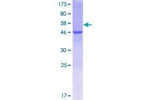 COMMD4 Protein (AA 1-199) (GST tag)